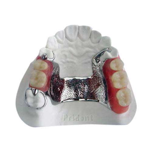 Casting Denture and CAD-CAM Denture Casting Denture and CAD-CAM Denture